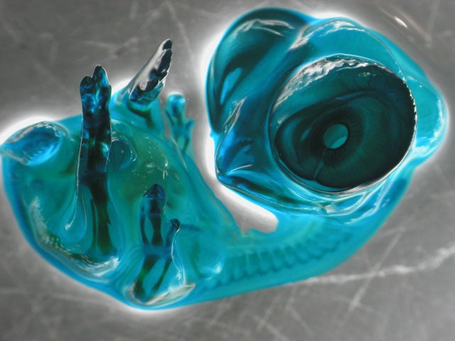 This shot of a nine-day-old chick embryo won first place in the popular vote on Nikon Small World's website. The <em>New York Times</em>'s John Tierney thinks that's just because it's <a href="http://tierneylab.blogs.nytimes.com/2008/10/20/a-small-big-eyed-chick/">so dang cute</a>, but I beg to differ: as ridiculously cool as it is, it looks something like a fruit snack-cum-monster. De Azevedo obtained this image by staining the embryo with green dye, immersing it in wintergreen oil, and photographing it with a <a href="http://www.microscopyu.com/articles/stereomicroscopy/stereointro.html">stereomicroscope</a>.