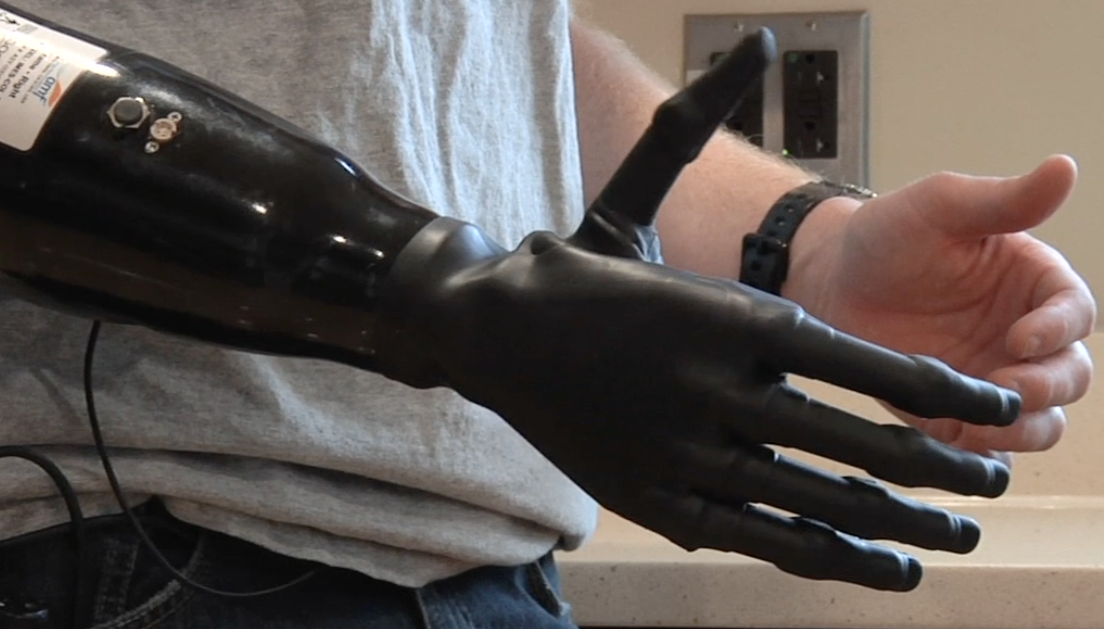 Video:  A Marine With A Prosthetic Hand Controlled By His Own Muscles