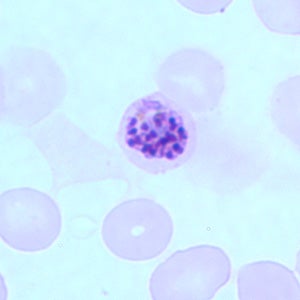 P. falciparum, the most lethal malaria-causing parasite, in a blood smear.