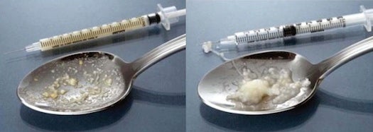Drug abusers sometimes dissolved crushed older OxyContin into an injectable mixture (left), but the newer formula makes a stringy jelly when mixed with liquid (right).