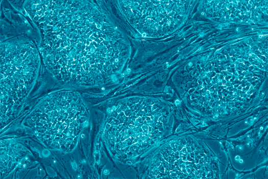 Researchers Turn Cloned Human Embryo into Working Stem Cell Line