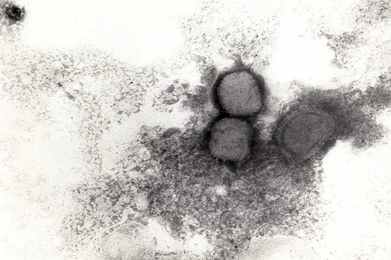 smallpox virus