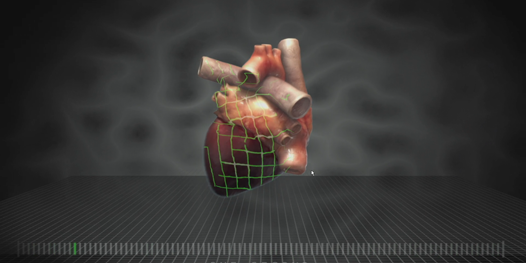 How Computer Modeling Lets Doctors Predict Heart Attacks Before They Happen