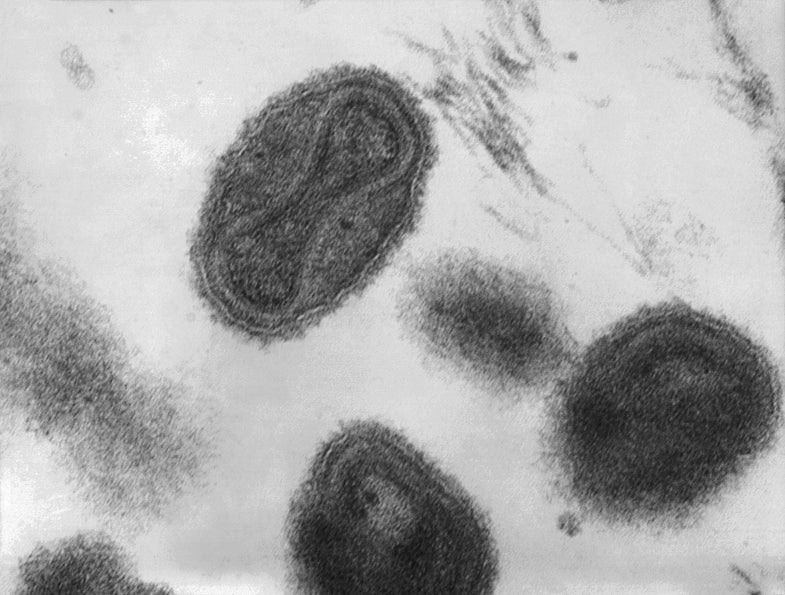 Smallpox Samples Slated For Immediate Destruction Are Still Intact, Pending Red Tape