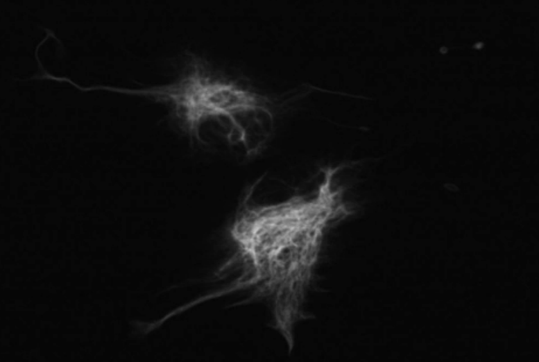 WATCH THE VIDEO! Vimentin is an important protein used in the cytoskeleton, the cells that give our bodies shape and structure. This video captures the whispy-looking protein going through mitosis in which the cells divide, sped up to 40 times its natural speed.