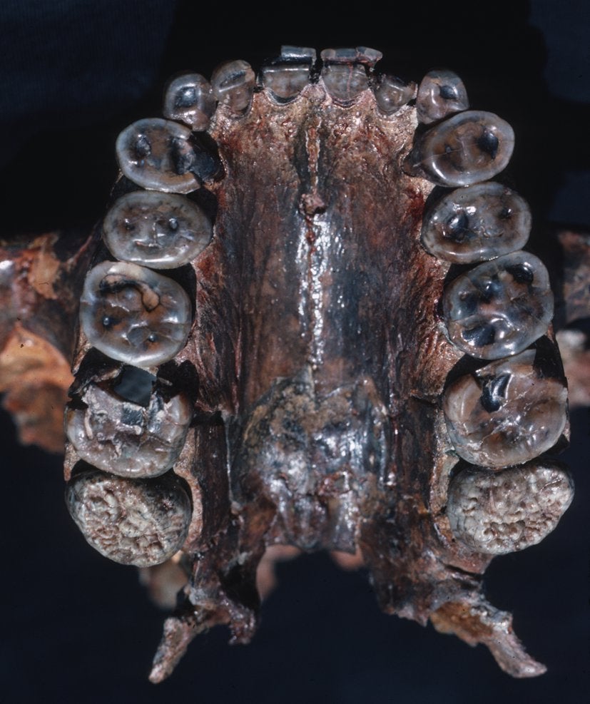 The teeth of a "Nutcracker Man" skull show marks of wear and tear.