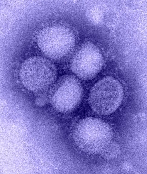 Swine Flu Consistent with Other Pandemic Strains