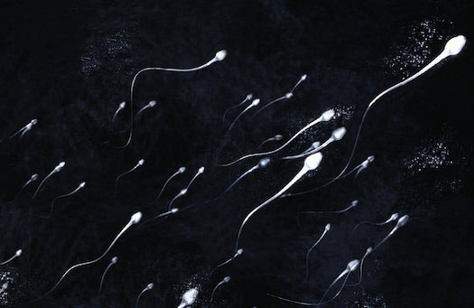 Sperm all swimming in one direction (Digital)