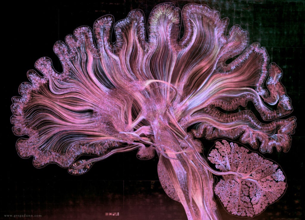 Human brain illustration | Vizzies winner