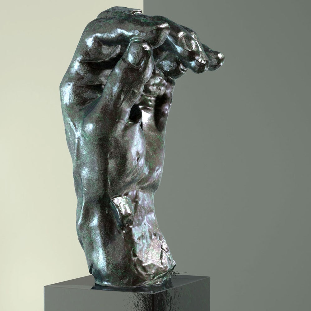 Chang observed that this sculpture looks like a patient with a hand fracture. Fractures can cause pain, stiffness and loss of movement, and can lead to long-term problems including weakness in the hand or early arthritis.
