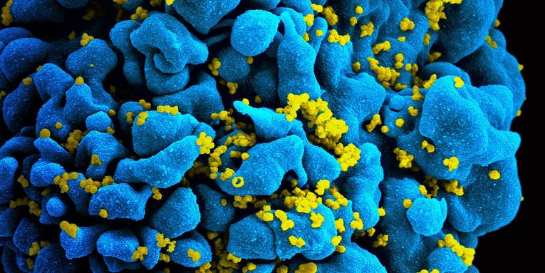 The first woman has been cured of HIV using donor stem cells