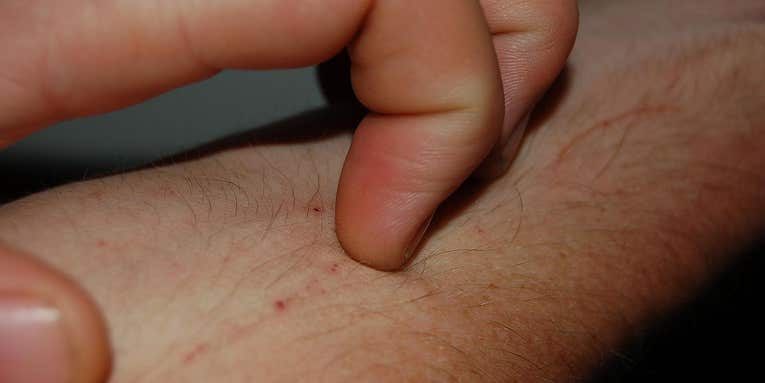 Why Does A Fly Landing On Your Arm Make You Itch?