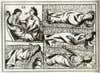 Drawings of Aztec smallpox victims