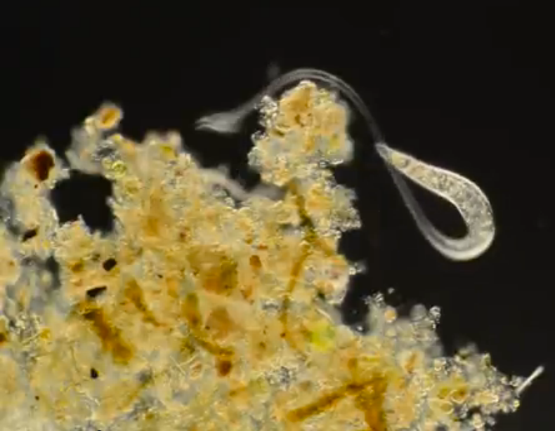 WATCH THE VIDEO! <em>Lacrymaria olor</em> is a protozoan about .1 mm long that lives in fresh water. It is named for its shape, which is thought to rather poetically resemble a swan's tear, and can extend its "neck" up to seven times the length of its body, as is visible in this video.