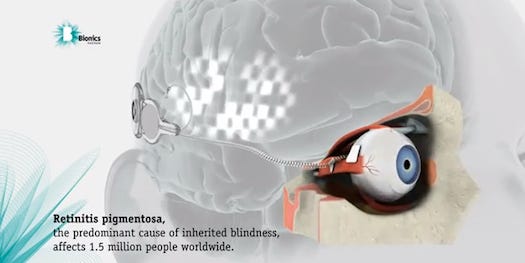 In World First, Scientists Surgically Implant a Working Bionic Eye In a Blind Patient