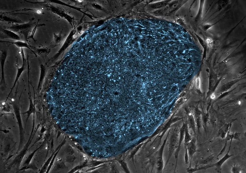In this image, the human embryonic stem cells are colored blue.