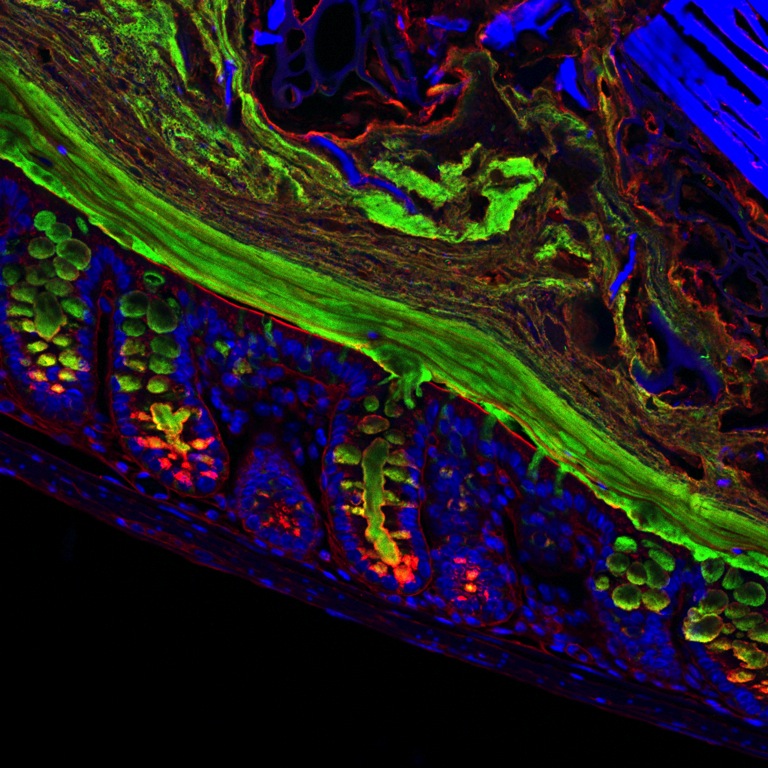 The crucial mucus layer that protects our gut is constantly being renewed. This image of a standard mouse gut shows a close-up of mucus (green) being formed by goblet cells (in pockets surrounded by blue host tissue) and then released into the mucus barrier. "The mucus forms sheets that build on top of each other, forming a boundary," explains Kristen Earle, a graduate researcher in microbiology and immunology at Stanford University and co-author of the new study. "On top of this layer is a looser layer, that forms a habitat for bacteria."