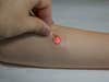 An image of the lighting red LED of the pulse rate monitoring device mounted on skin.