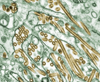 Colorized transmission electron micrograph of Avian influenza A H5N1 viruses (seen in gold) grown in canine kidney cells (seen in green).