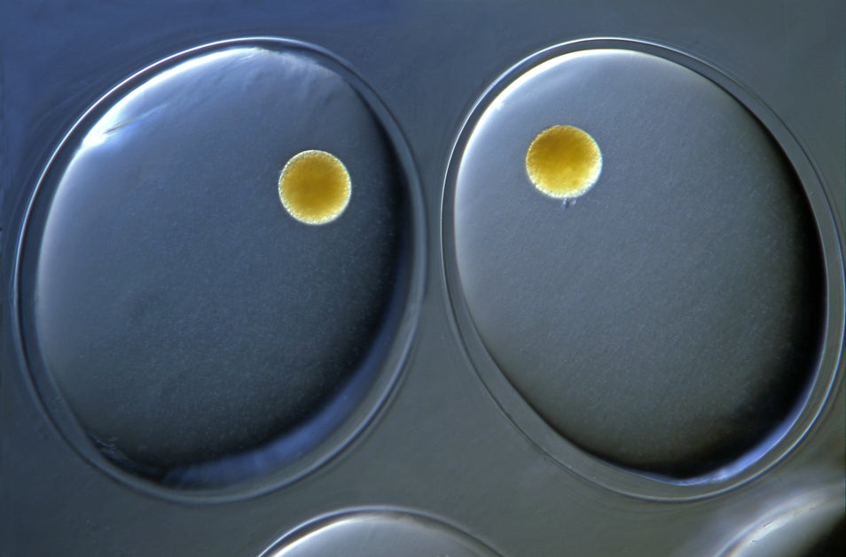 These symmetric ovals are actually the eggs of a pond snail. Snails deposits their eggs in large jelly-like clumps into the water. This picture shows a close-up of two of these eggs, with embryos developing inside them.