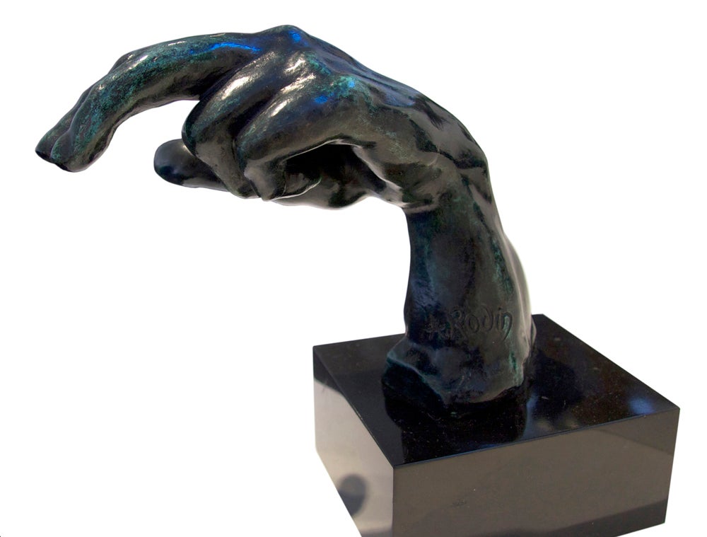 This sculpture reminded Chang of the medical condition Dupuytren’s contracture, a hand deformity caused by a thickening of the fibrous tissue layer underneath the skin of the palm and fingers. Once knots of tissue form under the skin, the fingers get pulled into a bent position and cannot be straightened completely.