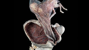 This Photo Of A Pregnant Pony Uterus Just Won A Wellcome Award