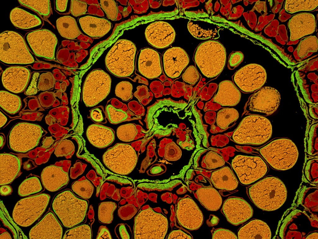 This cross-section of an anglerfish's ovary is reminiscent of another sea creature—the nautilus. Its otherwise-dull spirally composition caught James Hayden's eye, so he used fluorescent hematoxylin and Eosin stains to illuminate the different details of the image. "I was trying to create an image that sharply defined the boundaries of the different parts of the specimen, so that the image could actually be used to demonstrate the morphology of the ovary and eggs," he says.