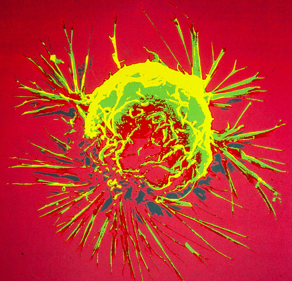 This “map” could change the way we treat cancer