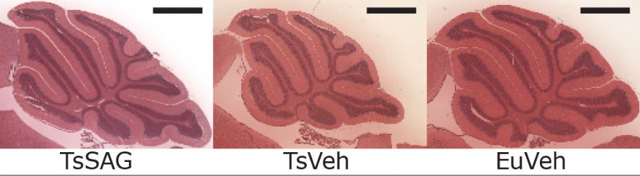 SAG-injected mice (TsSAG) versus non-SAG-treated Down syndrome mice (TsVeh) versus normal mice (EuVeh)