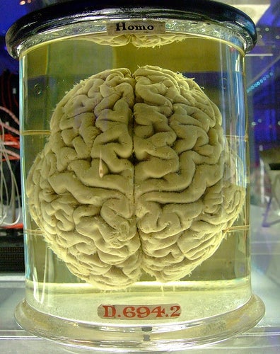 Scientists to Football Players: Give Us Your Brains