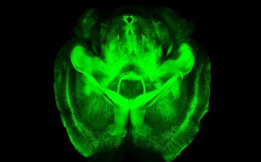 New Stanford Technique To Make Brains Transparent