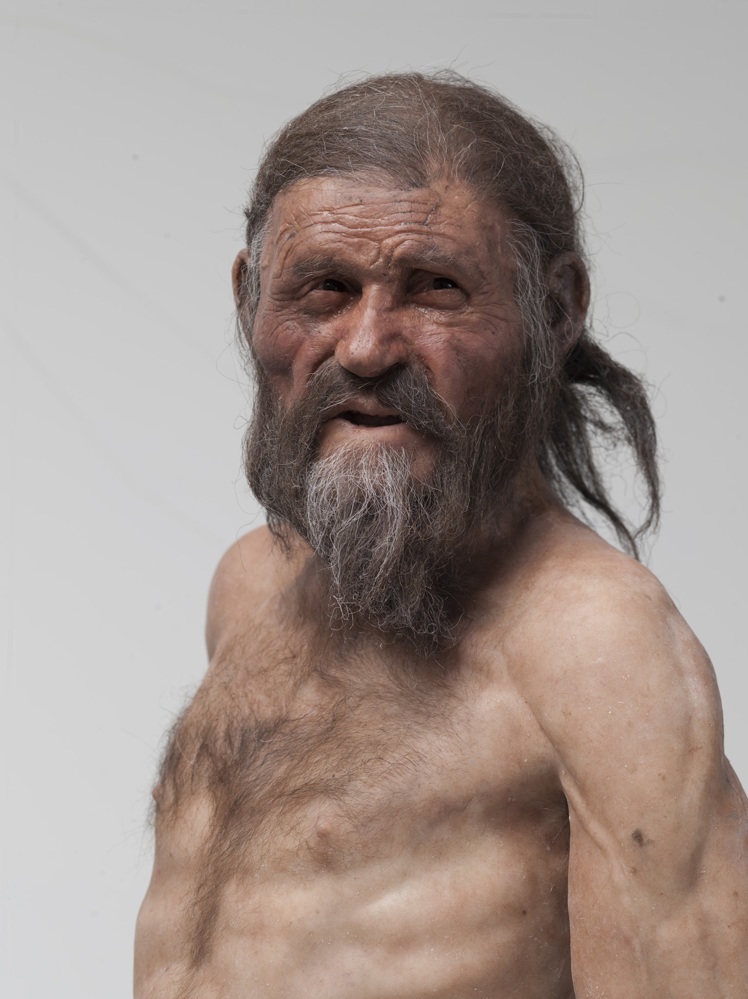 Iceman’s Stomach Bug Gives Clues To Humans’ Spread Into Europe