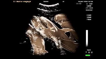 Check Out The First-Ever Shark Sonogram