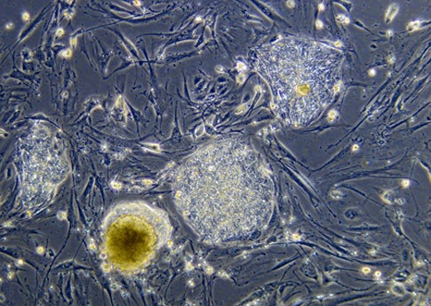 Court Ruling Reinstates Federal Embryonic Stem Cell Funding (For Now)