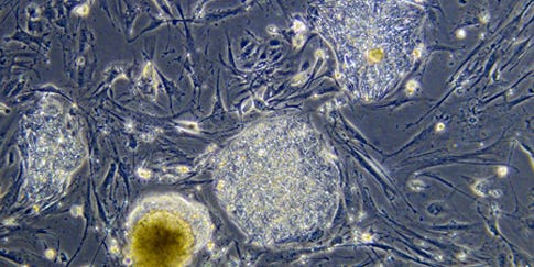 Federal Judge Halts Obama’s New Embryonic Stem Cell Policy, Leaving Research in Limbo
