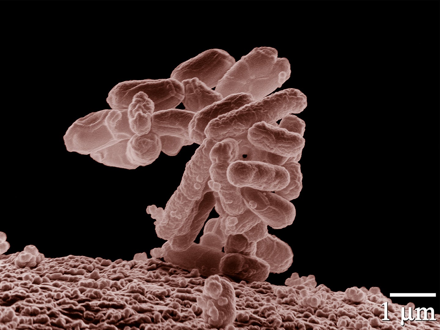 Escherichia coli is a member of the Enterobacteriaceae family of bacteria and is found in the human gut. Researchers have found several species of bacteria, including E. coli, carrying a gene that confers resistance to a class of last-resort antibiotics on a swine farm.