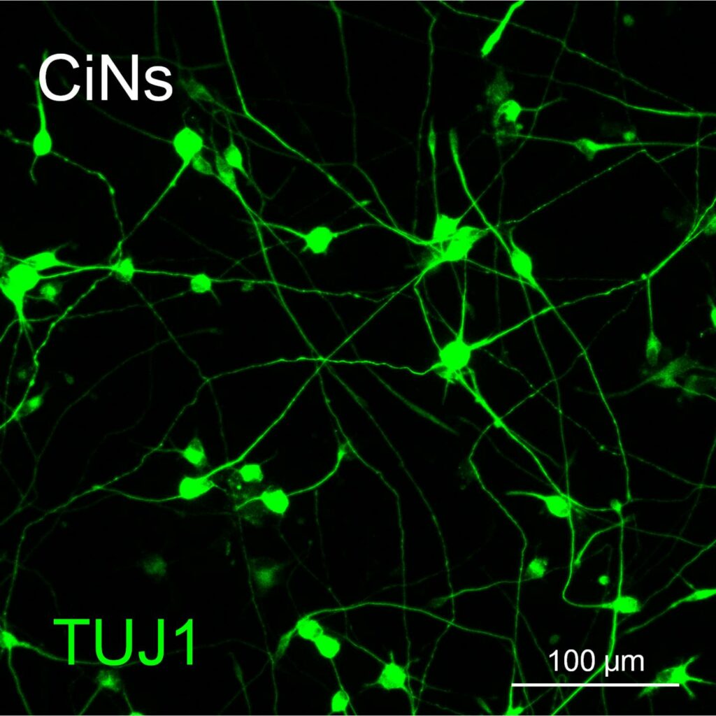 Researchers, in <a href="http://www.eurekalert.org/pub_releases/2015-08/cp-ccr073015.php">two separate <em>Cell Stem Cell</em> studies</a> this week, turned skin cells into neurons – in humans and in mice. They only used chemicals to accomplish this, which is safer and easier than using the previous method of transcription factors to make the transformation. This image shows the reprogrammed mouse neurons in green. Both studies could help scientists understand how neurons are programmed, <a href="http://www.the-scientist.com/?articles.view/articleNo/43688/title/Chemical-Cocktails-Produce-Neurons/">The Scientist</a> reported.