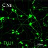 Researchers, in <a href="http://www.eurekalert.org/pub_releases/2015-08/cp-ccr073015.php">two separate <em>Cell Stem Cell</em> studies</a> this week, turned skin cells into neurons – in humans and in mice. They only used chemicals to accomplish this, which is safer and easier than using the previous method of transcription factors to make the transformation. This image shows the reprogrammed mouse neurons in green. Both studies could help scientists understand how neurons are programmed, <a href="http://www.the-scientist.com/?articles.view/articleNo/43688/title/Chemical-Cocktails-Produce-Neurons/">The Scientist</a> reported.