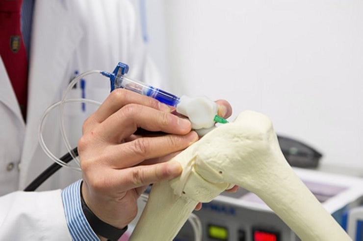 A Pen That 3-D Prints Bone Right Onto Patients