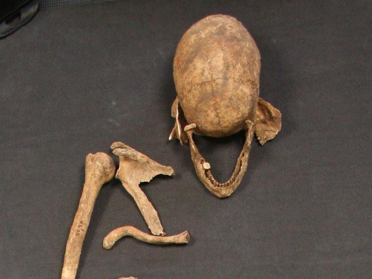These curved bones <a href="http://www.theguardian.com/science/2015/may/14/man-who-died-1500-years-ago-may-have-brought-leprosy-strain-to-uk">may have belonged</a> to the first man to bring leprosy to Britain. The Scandinavian man died in Essex 1,500 years ago. Though this skeleton was excavated more than 50 years ago, scientists have recently confirmed through DNA testing that the man did indeed have leprosy, making him the earliest known case in Britain. At the time, leprosy was incurable, disfiguring, and highly contagious, and lepers were forced to live apart from society. The leprosy epidemic peaked between the 12th and 14th centuries.