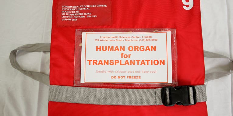 FYI: Are Organs Ever Re-Donated?