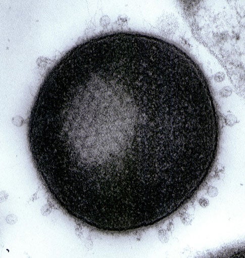 An electron micrograph of phages swarming an anthrax bacterium