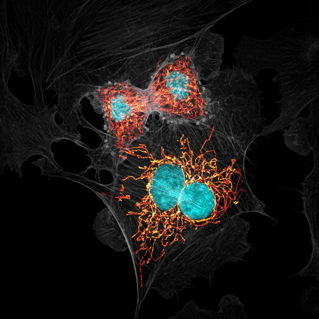 BPAE cells in telophase stage of mitosis