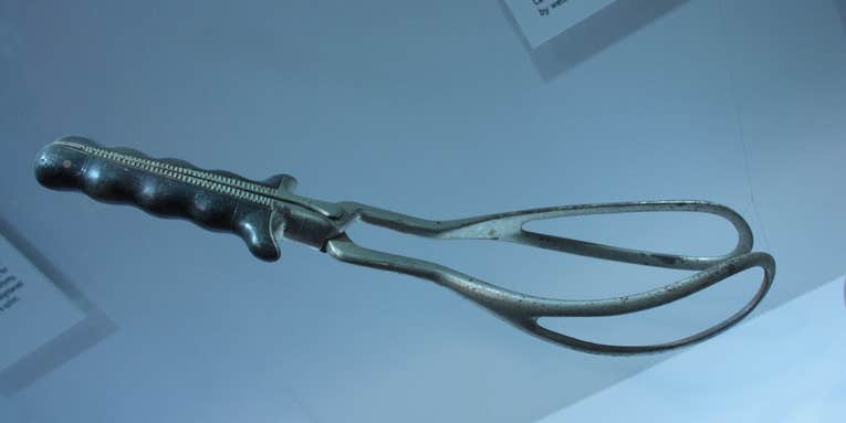 Forceps changed the way people give birth