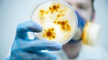 virus in a petri dish