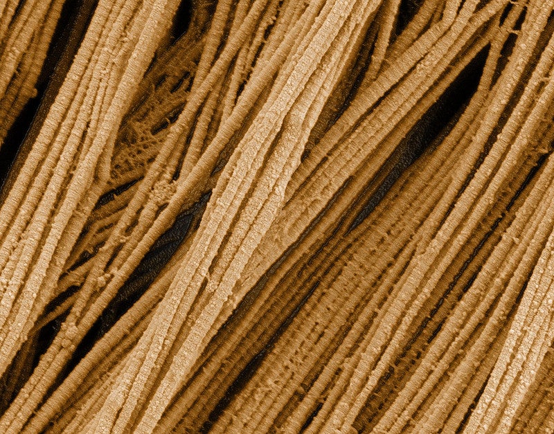 Collagen fibers, which make up a quarter of the protein mass in an adult human