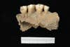 Ancient plaque on teeth