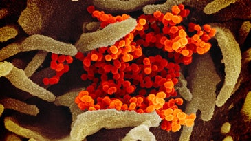 a microscope's view of an orange-stained virus