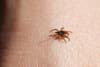 The deer tick, or blacklegged tick, is famed for spreading Lyme disease.