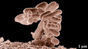 E. coli under a microscope